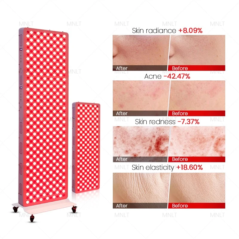 Red Light Therapy Panel – The Most Powerful Red & NIR Model high quality